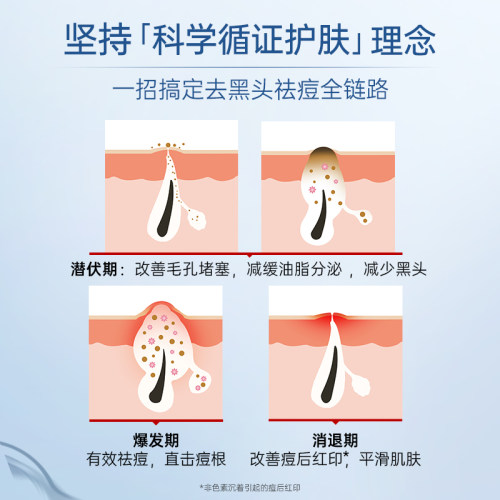 【小样】壬二酸凝胶祛痘印修护淡化痘印去黑头粉刺控油小样5g - 图1