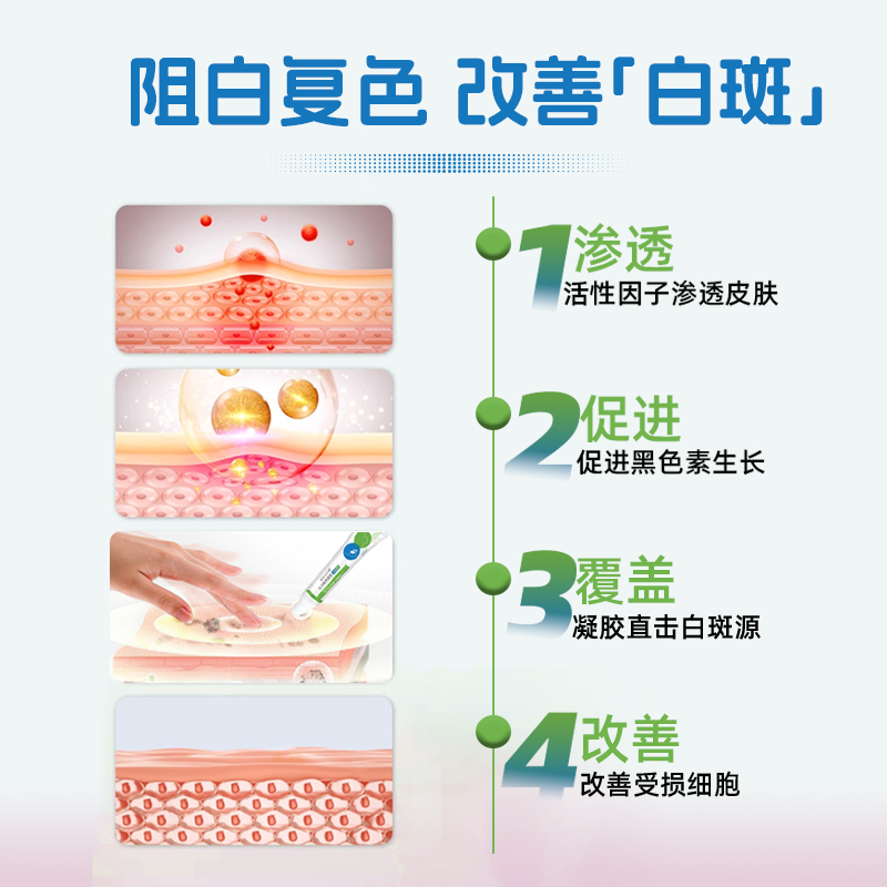 穆一堂穆家老药铺医用退热凝胶白斑型小白管皮肤色素减退脱失软膏-图1