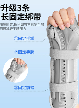 手腕尺桡骨腕关节骨折固定器