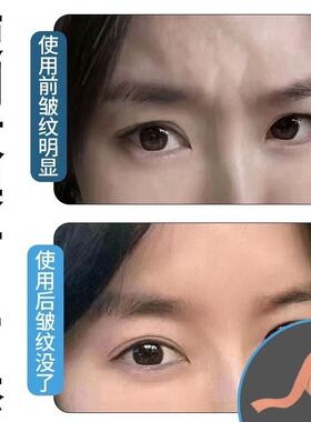 防止皱眉头神器川字纹贴眉间贴法令纹眼角额头贴抬头纹肌肉绷带