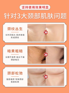 IN山羊奶六胜肽紧致颈膜颈部脖子面膜颈贴颈纹膜女官方舰旗店正品