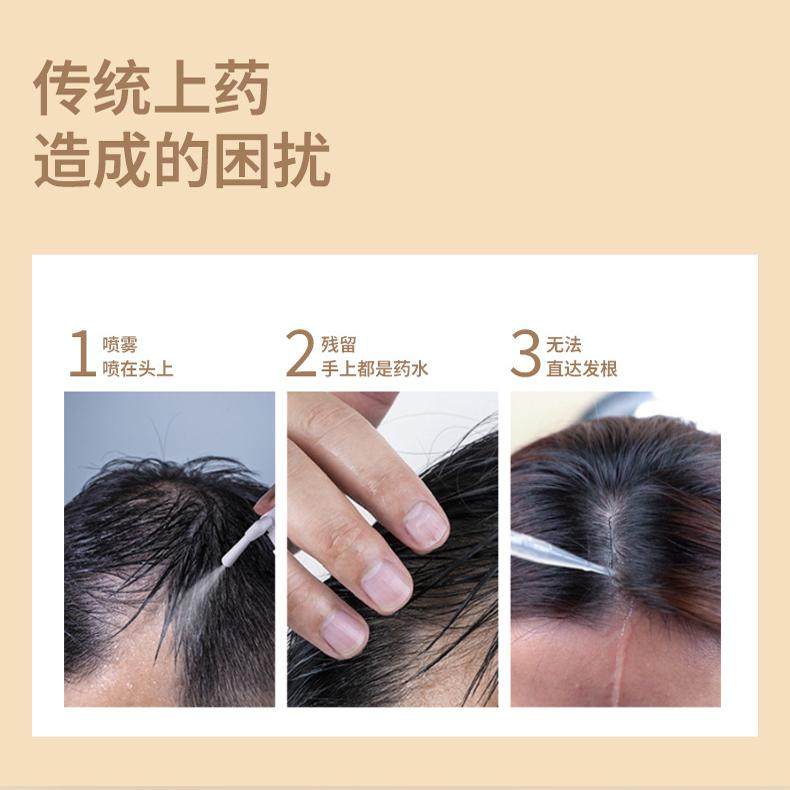 EMS电动头皮上药器滚珠按摩红光生发振动导液梳头疗辅助器15ml,淘宝优惠券,粉丝福利购,淘宝优惠卷