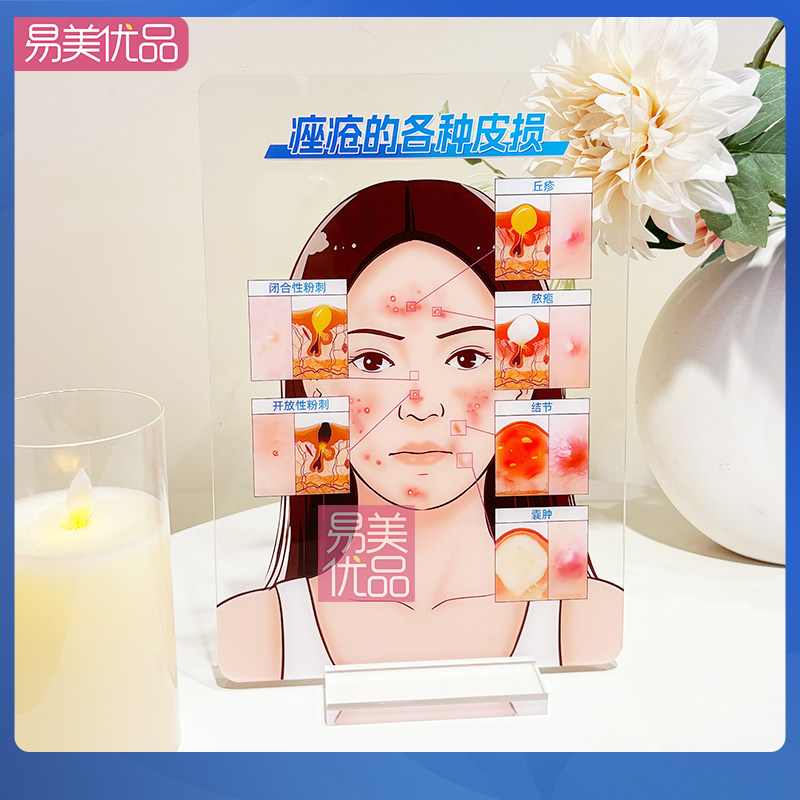 专业皮肤美学教具痤疮的各种皮损亚克力展示牌医患沟通项目介绍物