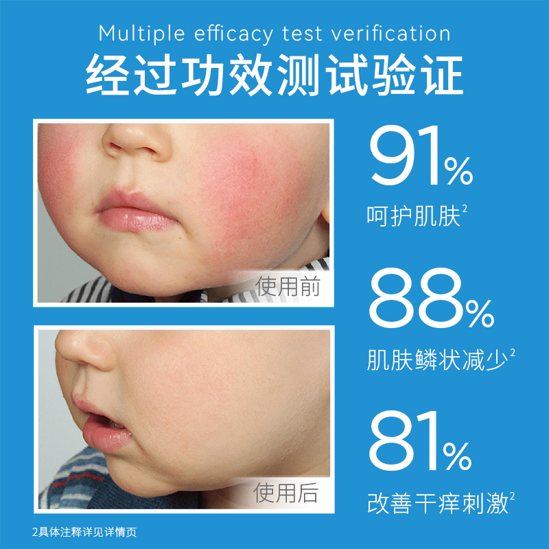 ISDIN怡思丁宝宝面霜儿童ad霜补水保湿舒缓干痒敏感肌