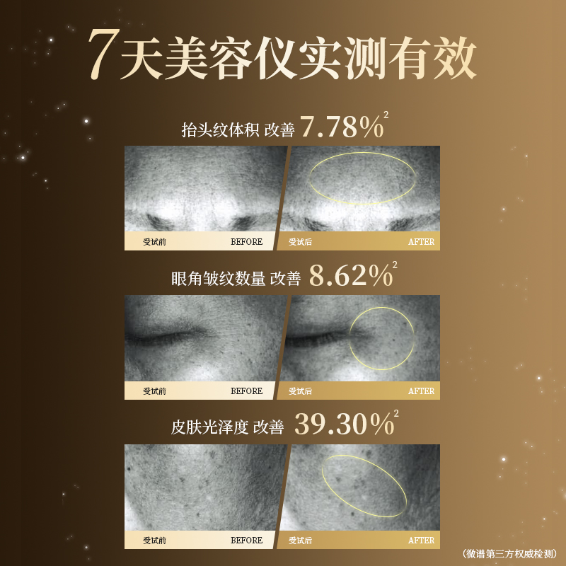 Rokkado/六花堂家用美容脸部超声炮淡纹提拉紧致七夕情人节送礼