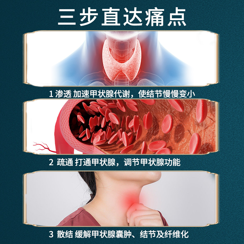 十二药坊甲状腺结节消散结贴脖子肿大甲减甲亢囊肿消除膏淋巴贴 - 图2