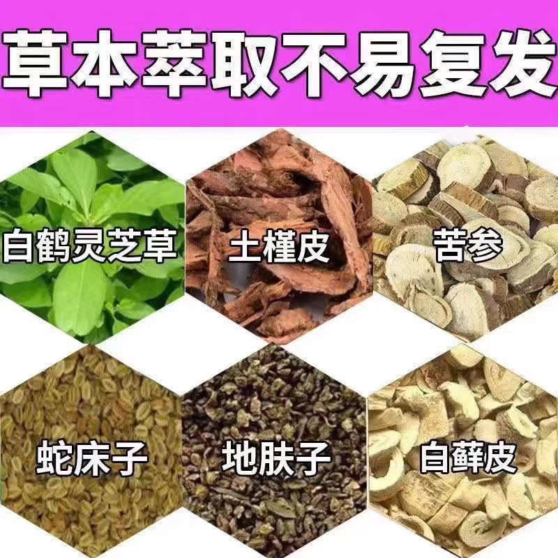 胳膊上起小疙瘩日光性皮炎皮肤剧烈瘙痒夏季皮炎紫外线过敏老牌膏 - 图2