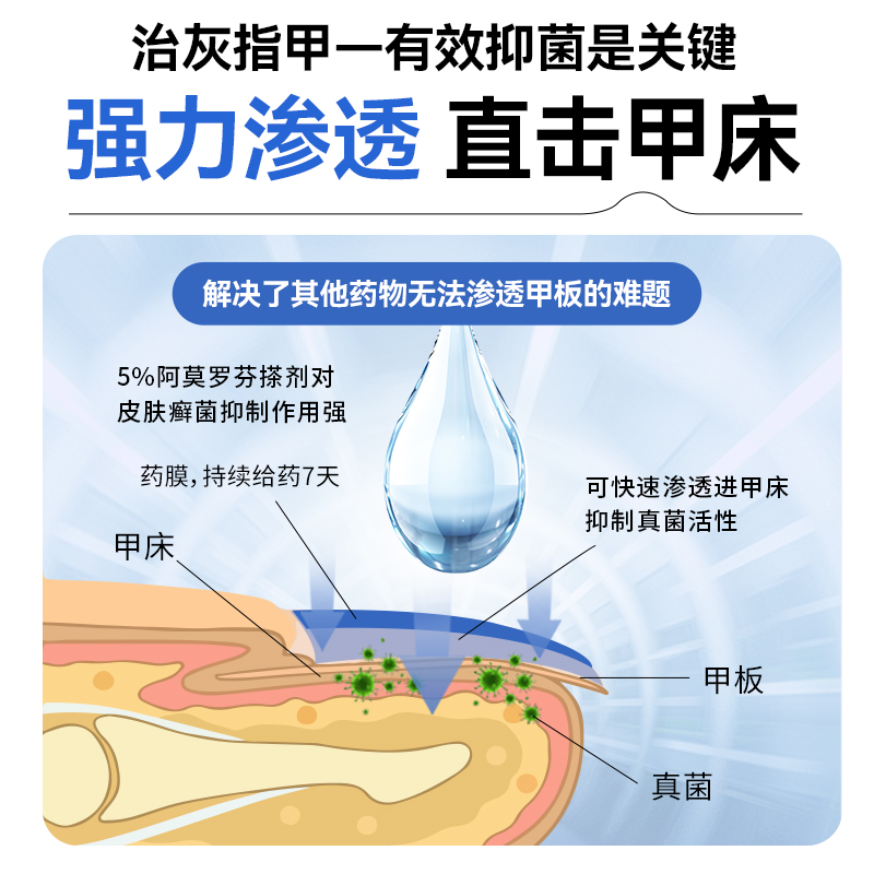 洛芙盐酸阿莫罗芬搽剂正品旗舰店灰指甲专用药阿莫罗芬搽剂甲癣药-图1