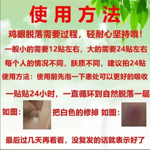 鸡眼贴鸡眼膏老茧肉刺肉粒脚丁死皮脚垫趾底手足专用 - 图0