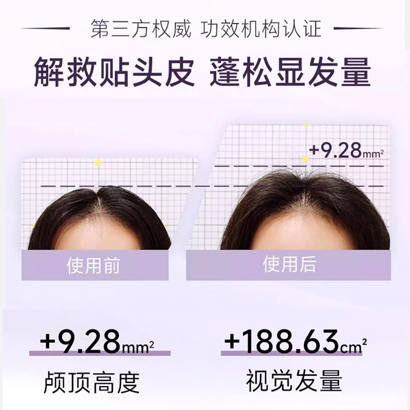 【旅行套】内见洗发水洗护合一清爽蓬松去屑柔顺旅行装30gx2 - 图2