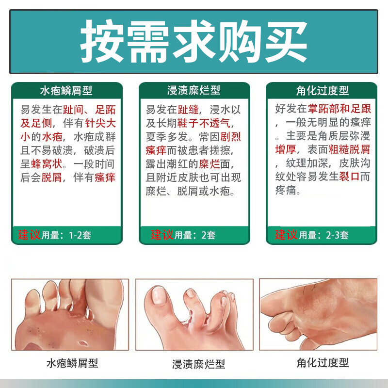 脚癣一次净足癣脚藓药房同款膏真菌感染脚气去后根止痒水泡型JH - 图2