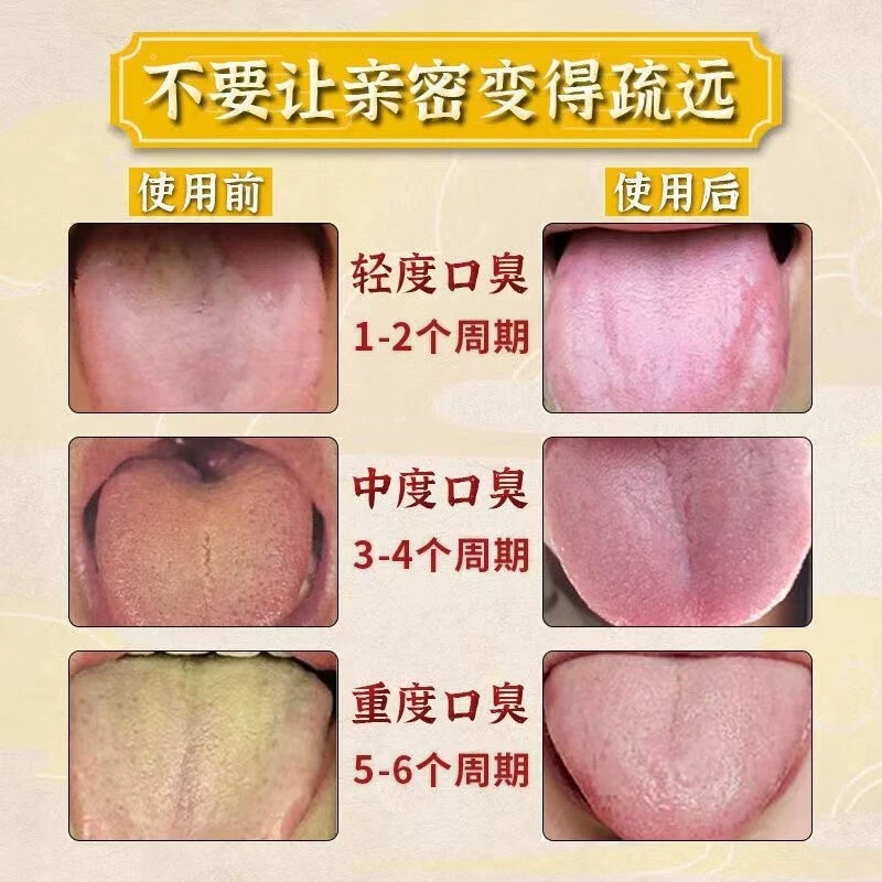 仁济堂龙胆泻肝丸官方旗舰店的功效颗粒张仲景龙丹泄肝丸汤ql