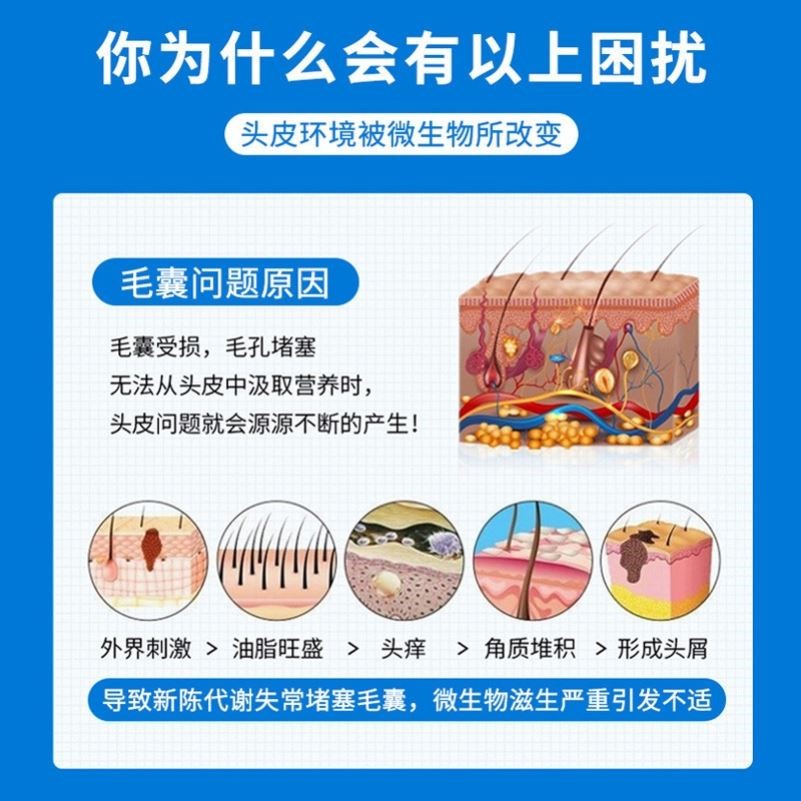 屑康王酮康挫油头控油去屑止痒抑菌洗剂毛囊清洁液-图2