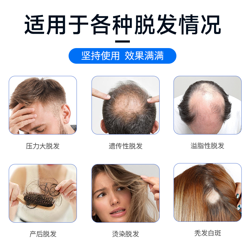 印度进口Hair 4U米诺地尔5%生发剂液增发育发密发喷雾防脱生发-图0