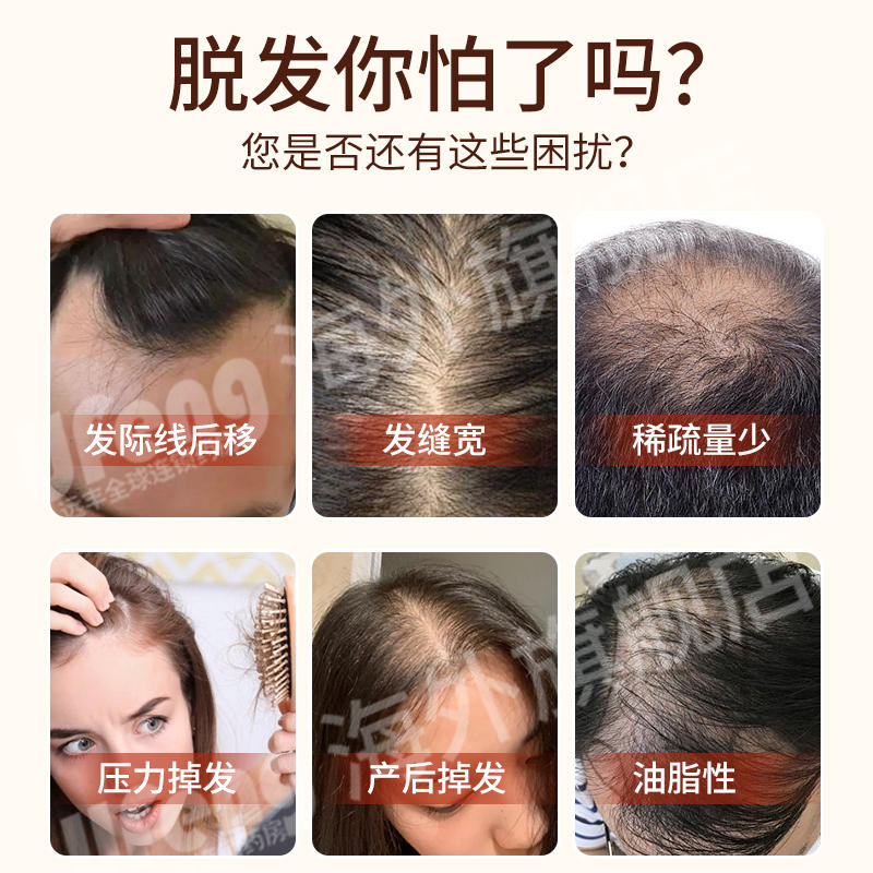 印度Hair 4U生发液60ml米诺地尔加非那雄胺防脱发生长头发掉密发-图1