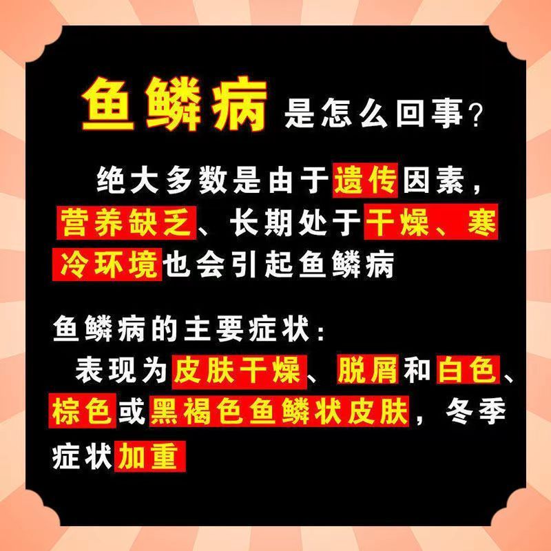 皮肤干燥引起的鱼鳞病脱屑银屑皮肤粗糙干燥起皮马应龙尿素软膏