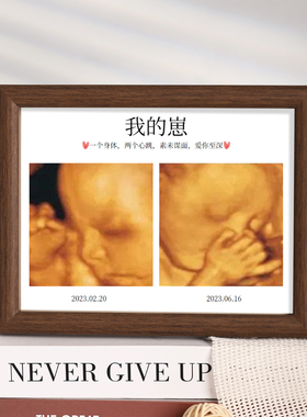 四维照片相框胎儿b超相框
