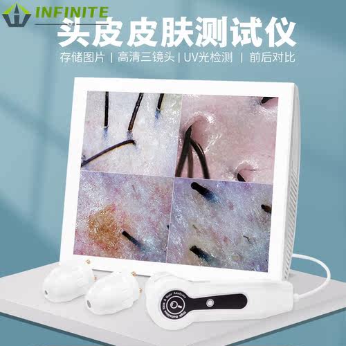 厂家美容院15寸平板头皮检测仪高清一体机智能毛囊毛发分析仪 - 图2