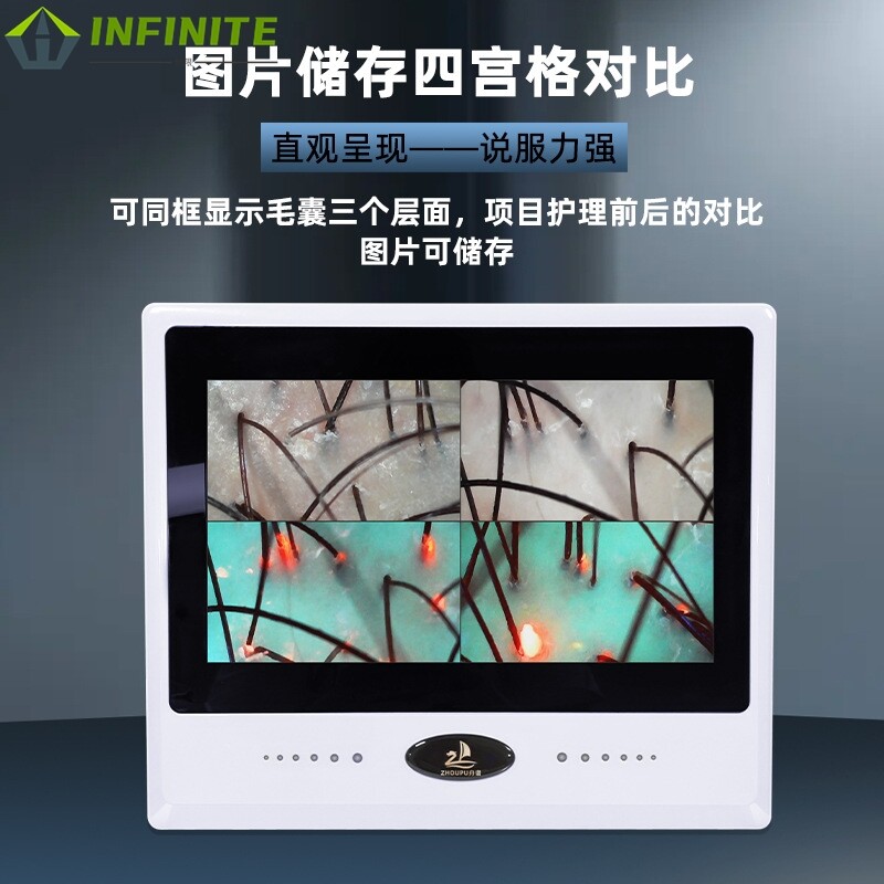 舟谱虎视镜头皮检测仪器高清三光谱皮肤毛囊分析一体机毛发测试仪