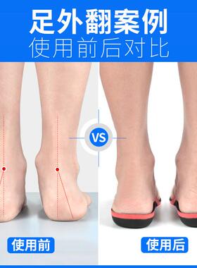 成人足外翻扁平足专用矫正鞋垫