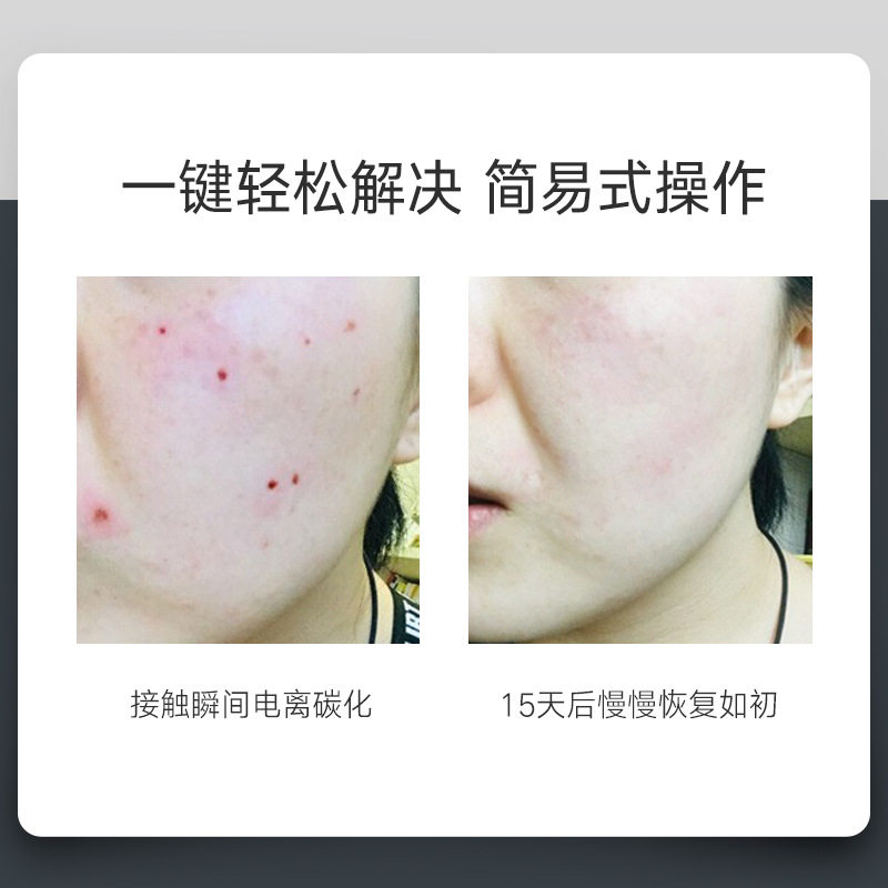 点疣笔美容院专用祛扁平疣丝状疣黑肉痣尖锐疣肉芽瘊子去痦子神器,淘宝优惠券,粉丝福利购,淘宝优惠卷