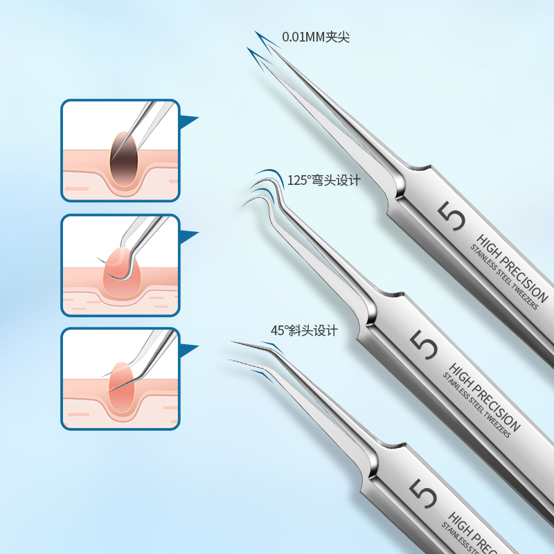 粉刺夹黑头夹镊子美容院专用刮闭口粉刺黑头痘痘针工具神器套装 - 图2