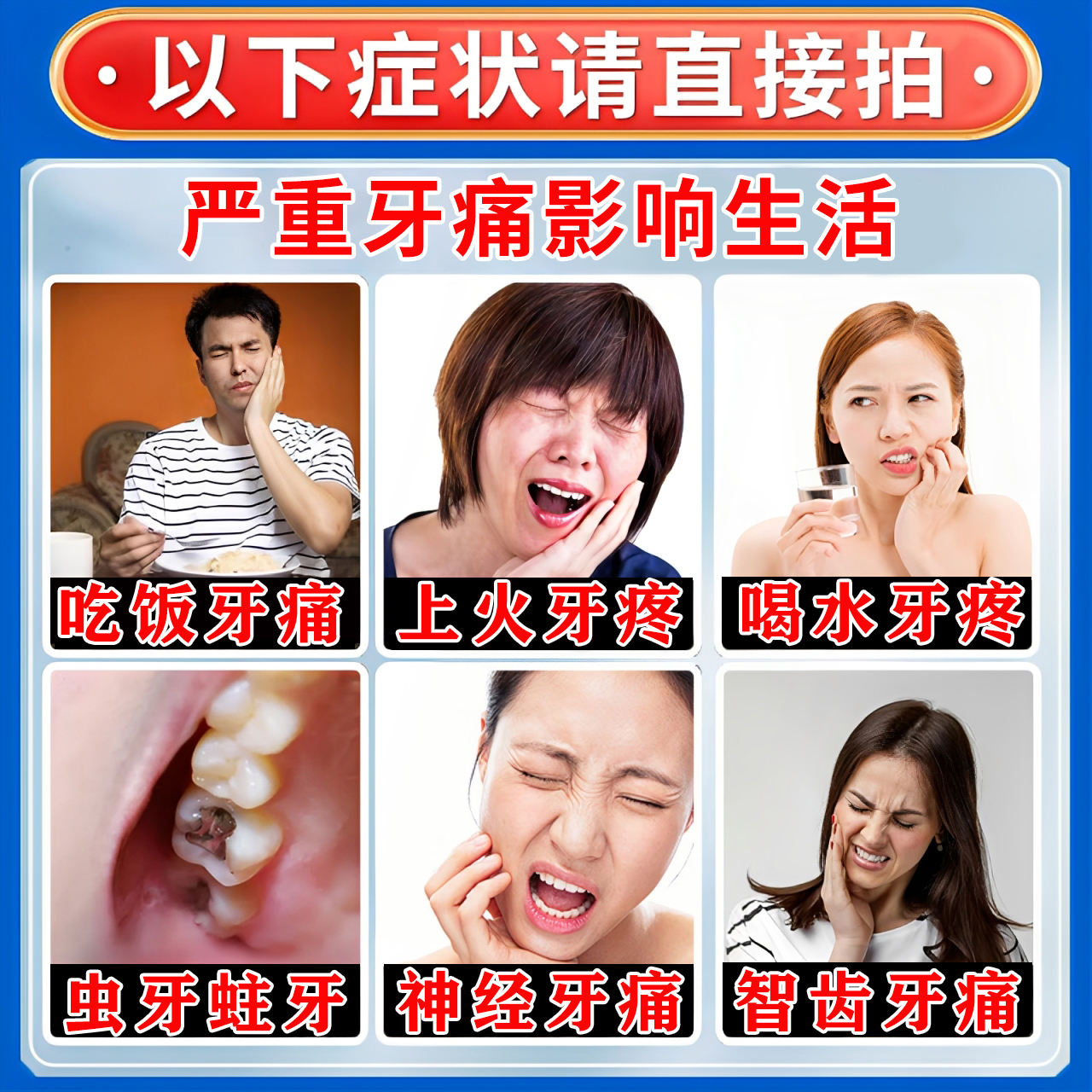 治牙痛牙疼止疼药速特新效药消炎止痛牙疼牙龈肿痛消炎药牙痛药水 - 图0