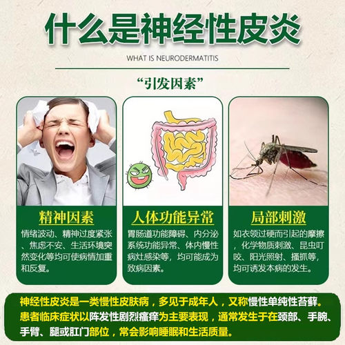 神经性皮炎特药效治疗顽固外用膏止痒肤病癣藓湿疹真菌感染瘙痒LT - 图1