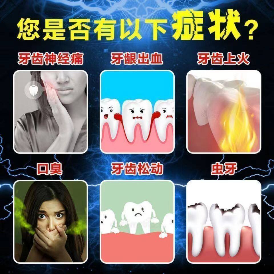 牙痛止痛药牙龈肿痛神经性牙疼牙周炎冷热刺痛消肿止痛老式去痛片