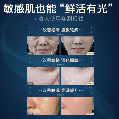 弥芙泉敏感肌保湿面霜补水修护乳液紧致抗皱泛红干燥舒缓赋活霜 - 图3