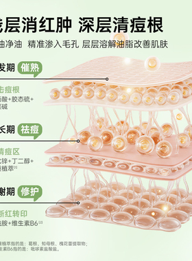 百草妈咪祛痘淡化痘印精华液