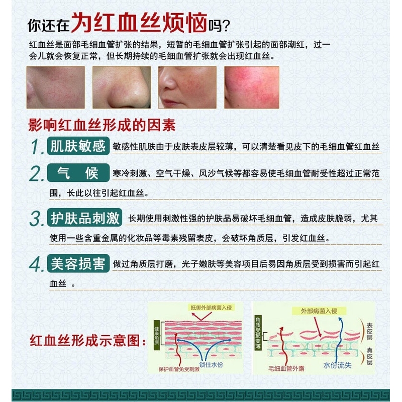 脸红修复去红血丝增厚角质层祛高原红脸蛋改善敏感肌肤专用护肤品 - 图1