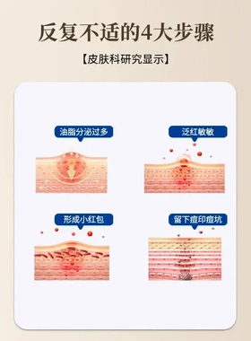 云南本草七子白洗脸皂控油去黑头深度清洁草本温和养肤香皂全身用