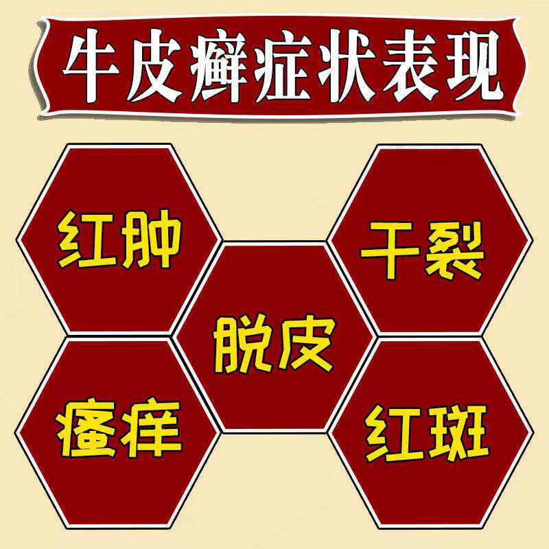  懩生宝大药房癣症