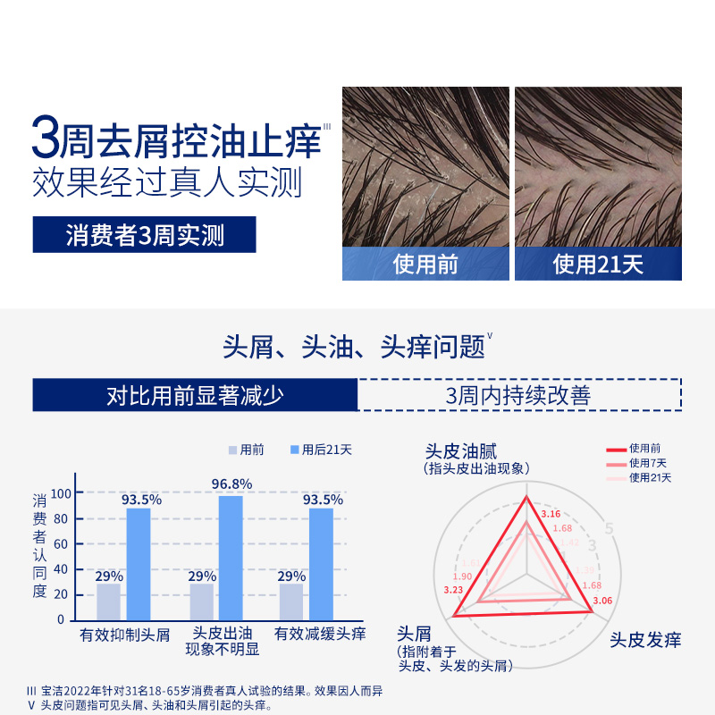 海飞丝洗发水专研去屑洗发露止痒/控油头皮护理洗发膏任选