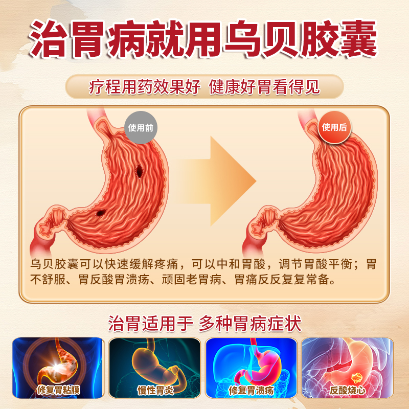 多泰乌贝胶囊旗舰店otc乌贝散中成药制酸止痛胶囊反酸烧心肠胃药