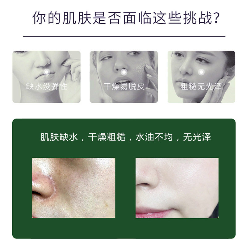 Han Ming Aloe Vera Water Lotion Set Hydrating and Moisturizing
