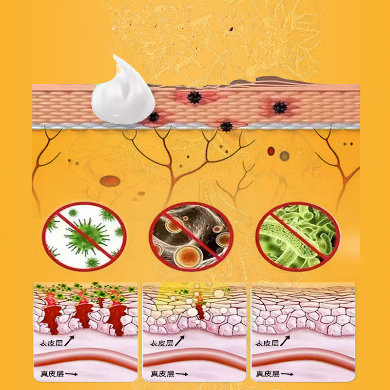 香港大药房断痒王止痒膏皮肤痒断痒膏止痒王正品乳膏身上痒,淘宝优惠券,粉丝福利购,淘宝优惠卷