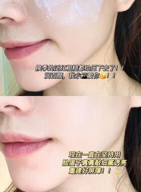 润百颜面霜敏肌养出城墙厚的皮