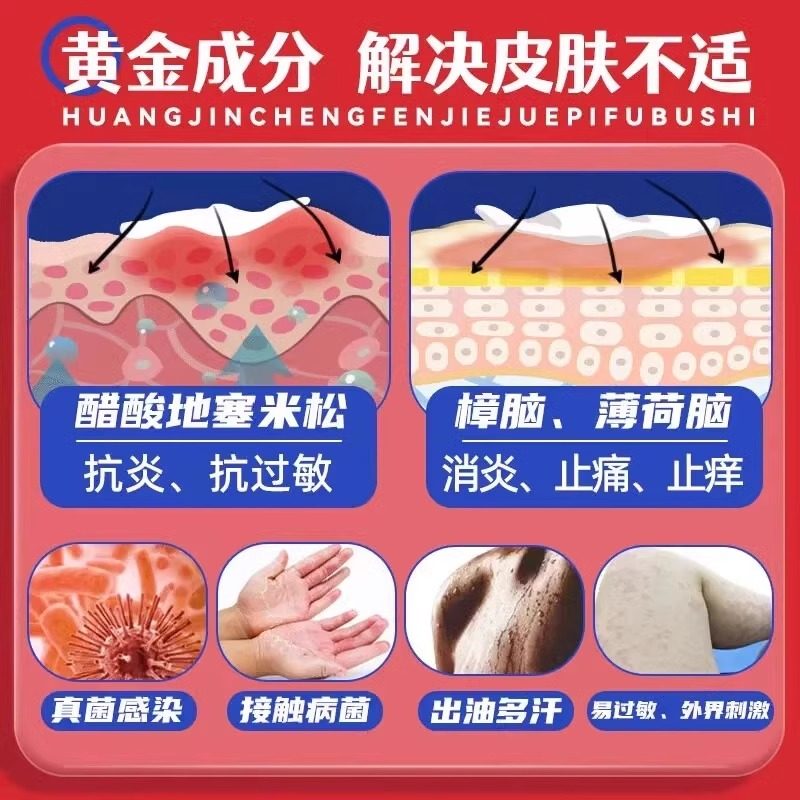 999皮炎平神经性皮炎外用膏治皮肤瘙痒湿疹止痒药过敏瘙痒症药膏,淘宝优惠券,粉丝福利购,淘宝优惠卷