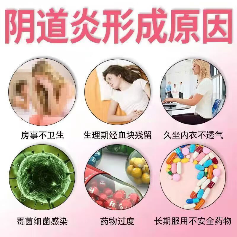 甲硝唑消炎片阴泡腾片治霉菌滴虫性阴道炎妇科药用药炎症用药