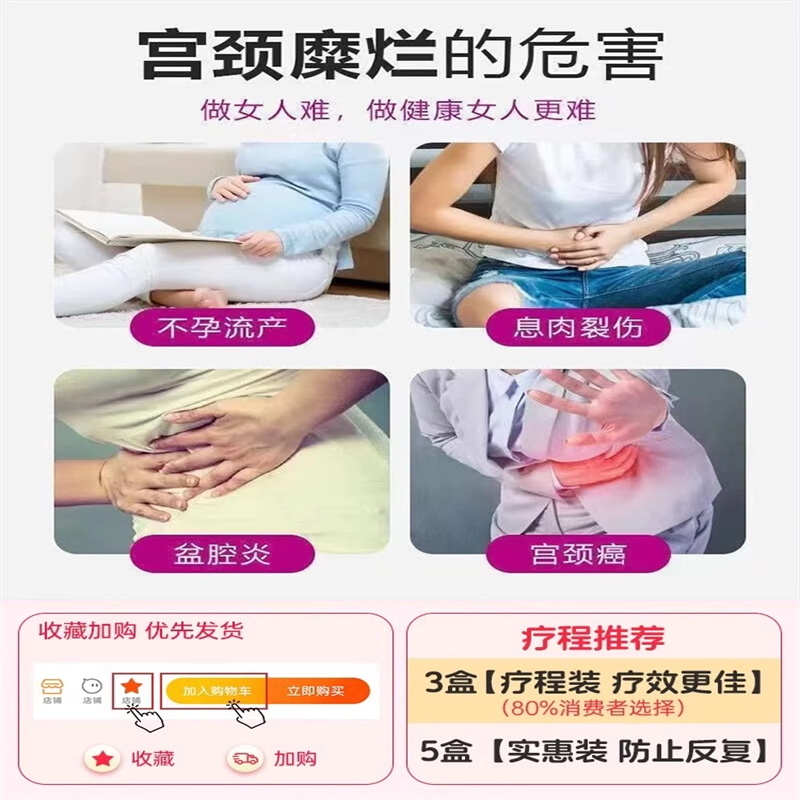 消糜栓 阴道炎妇科用药宫颈糜烂用药 治疗宫颈炎的药白带腥臭瘙痒 - 图1