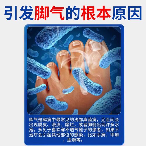 治脚气专用药水泡脱皮止痒烂脚丫痒脚趾缝糜烂型治疗真菌感染 - 图1
