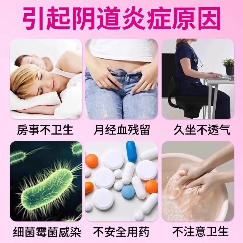 妇科外阴瘙痒专用止痒霉菌性阴道炎症私处瘙痒红肿抑菌消炎正品药