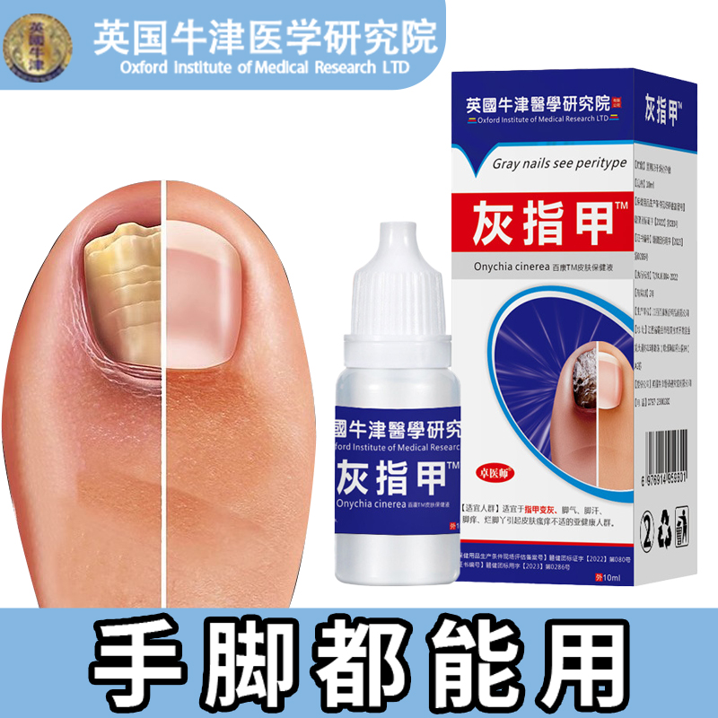 灰指甲沟炎专用特效抑菌液趾指甲膏护理保健液真菌感染正品旗舰店