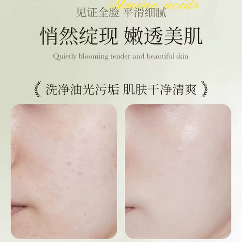 ZATI氨基酸洗面奶白茶清洁保湿洁面慕斯深层清洁敏感肌男女士正品 - 图1