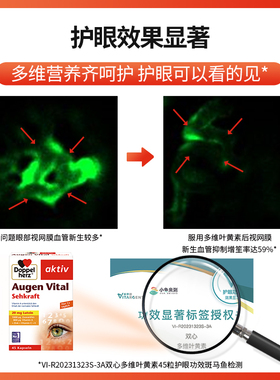 德国双心多维叶黄素30粒*3盒护眼片进口成人保护眼睛胶囊官方