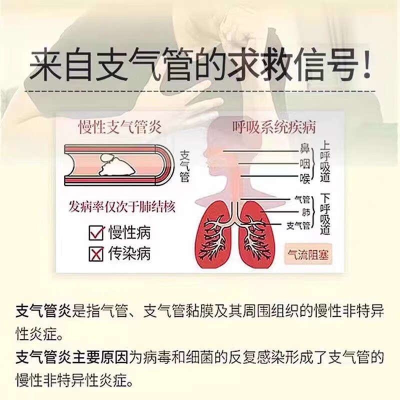 日本慢性支气管炎止咳清肺化痰贴咽喉肿痛喉咙发炎咳嗽止咳神器OL - 图1