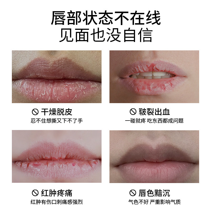 Topicrem特碧润唇膏保湿滋润淡唇纹去死皮修护唇膜女补水男防干裂