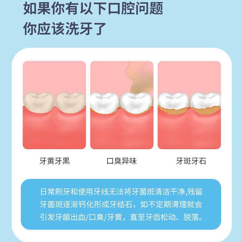 洗牙仪超声波牙结石去除器去黄牙垢口臭牙渍神器电动牙刷冲洁牙器 - 图2